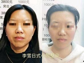 绣骨颜,揭秘古代刺绣艺术的魅力与传承